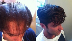 Men Flocking to Hair Extensions?! » 